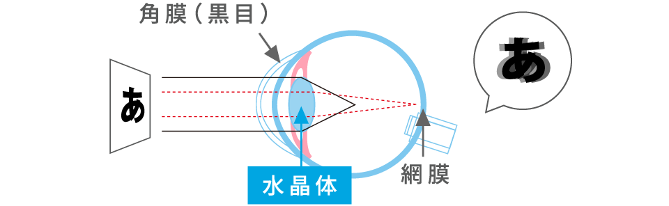 乱視の場合の文字の見え方