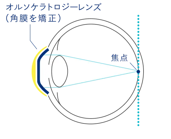 装用中