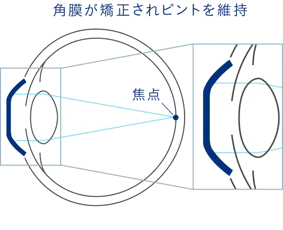 装用後(裸眼時)