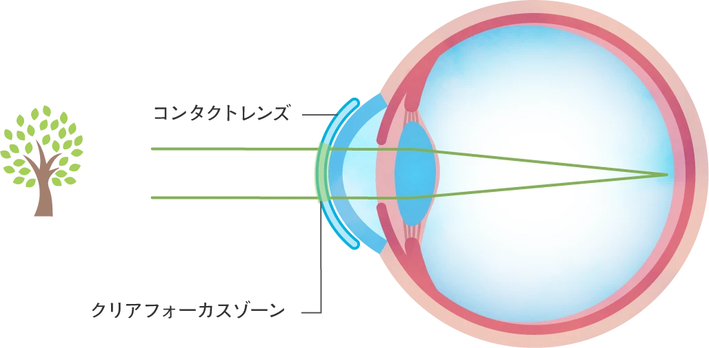 クリアフォーカスゾーン