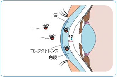 酸素透過性の高いコンタクトレンズ