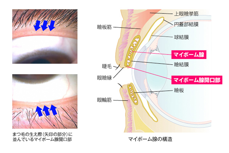 マイボーム腺のイメージ