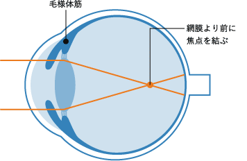 近視の目