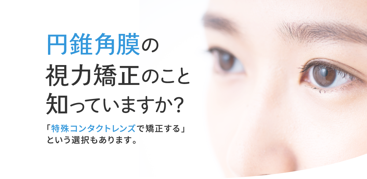 円錐角膜の視力矯正のこと知っていますか？「特殊コンタクトレンズで矯正する」という選択もあります。