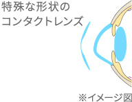 特殊な形状のコンタクトレンズのイメージ