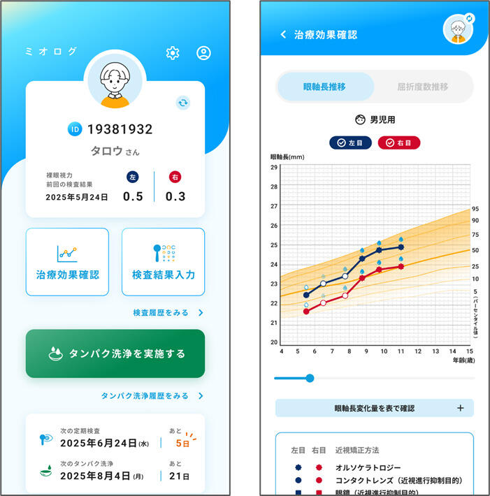 https://www.menicon.co.jp/company/news/65b766fd79503578aa84ec222348e008.jpg